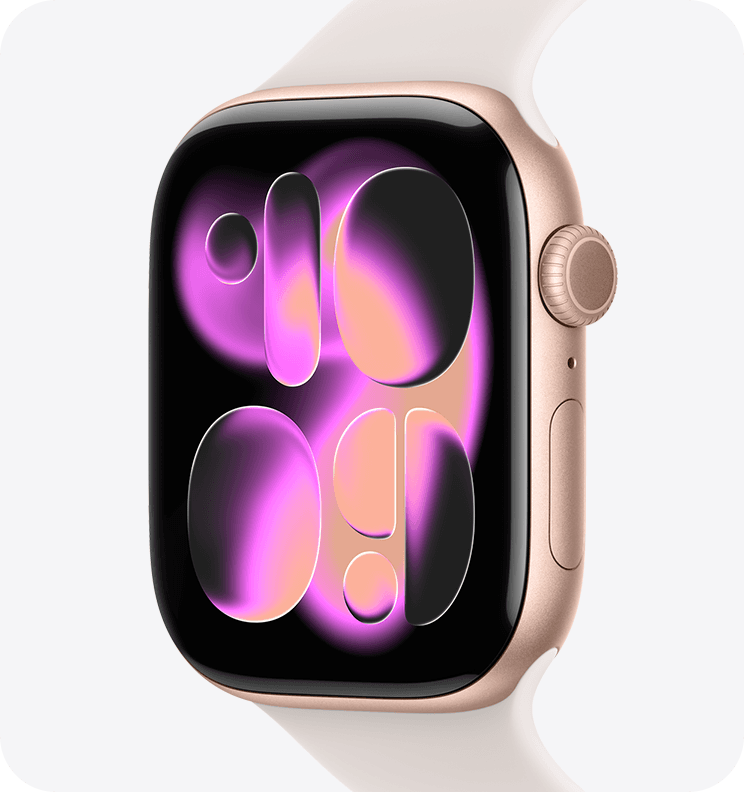 Apple Watch Series 11 · 46mm GPS